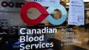 اخبار-کانادا-نیاز-به-اهدا-خون-دارد-اما-دادن-و-گرفتن-خون-در-کرونا-ایمن-است