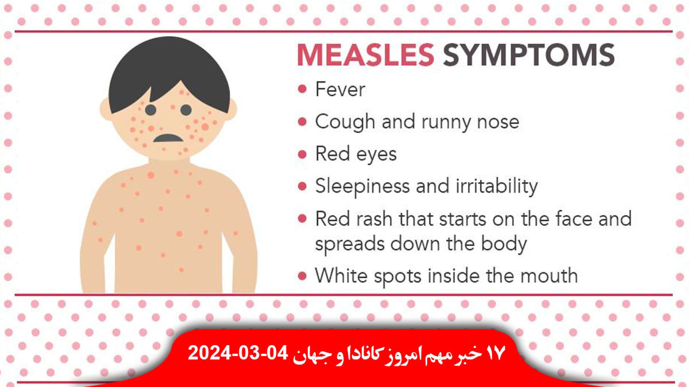 نگرانی-ثبت-سرخک-جدید-کبک-رکودشکنی-تورنتو-درجه-فلات-کانادا-دیوان-عالی-آمریکا-نفع-ترامپ-رای