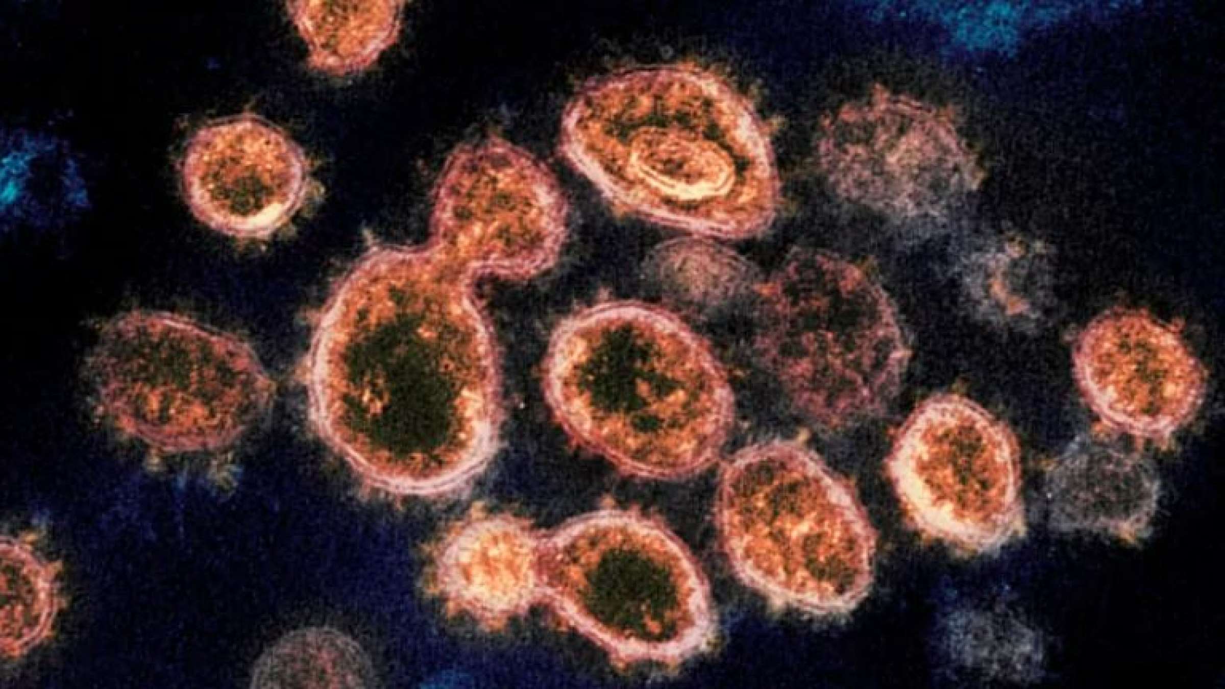 کرونا-به-قاتل-اصلی-جان-کانادا-یی-‌ها-تبدیل-شده-است-رکورد-شکنی-کرونا-در-سه-اونتاریو-آلبرتا-و- کبک-ابتلا-بیش-از- 228 -هزار-آمریکایی-به-کرونا-در-یک-روز