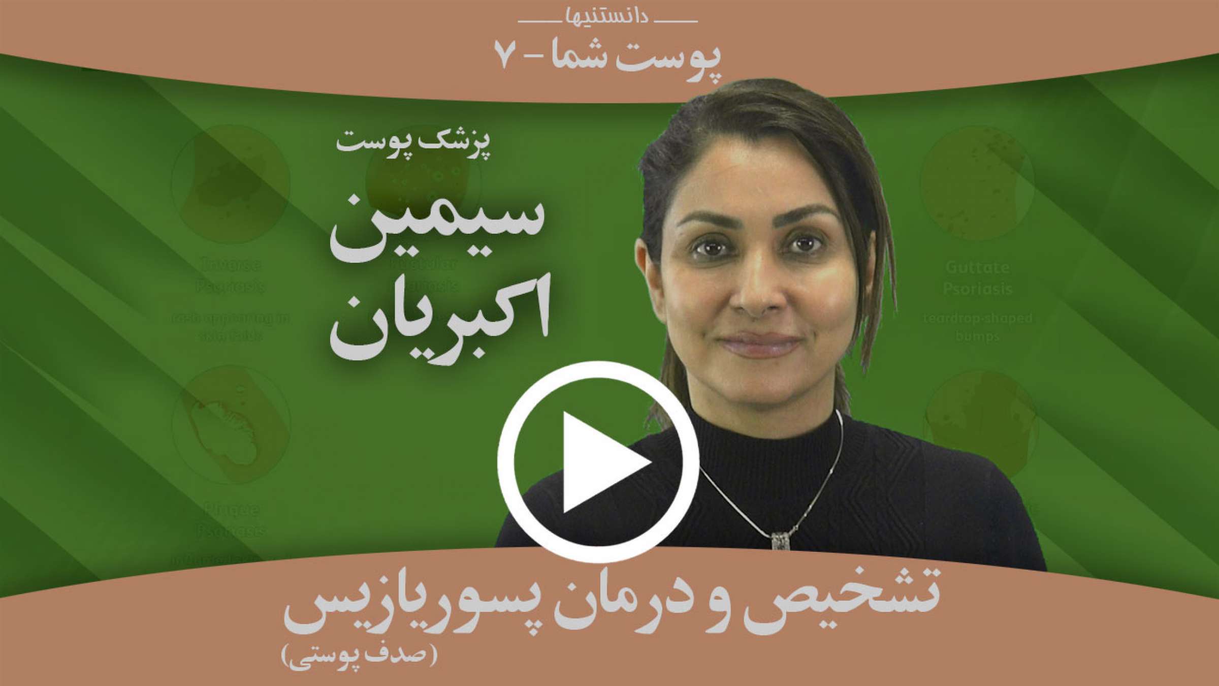 تشخیص و درمان بیماری پسوریازیس چیست؟