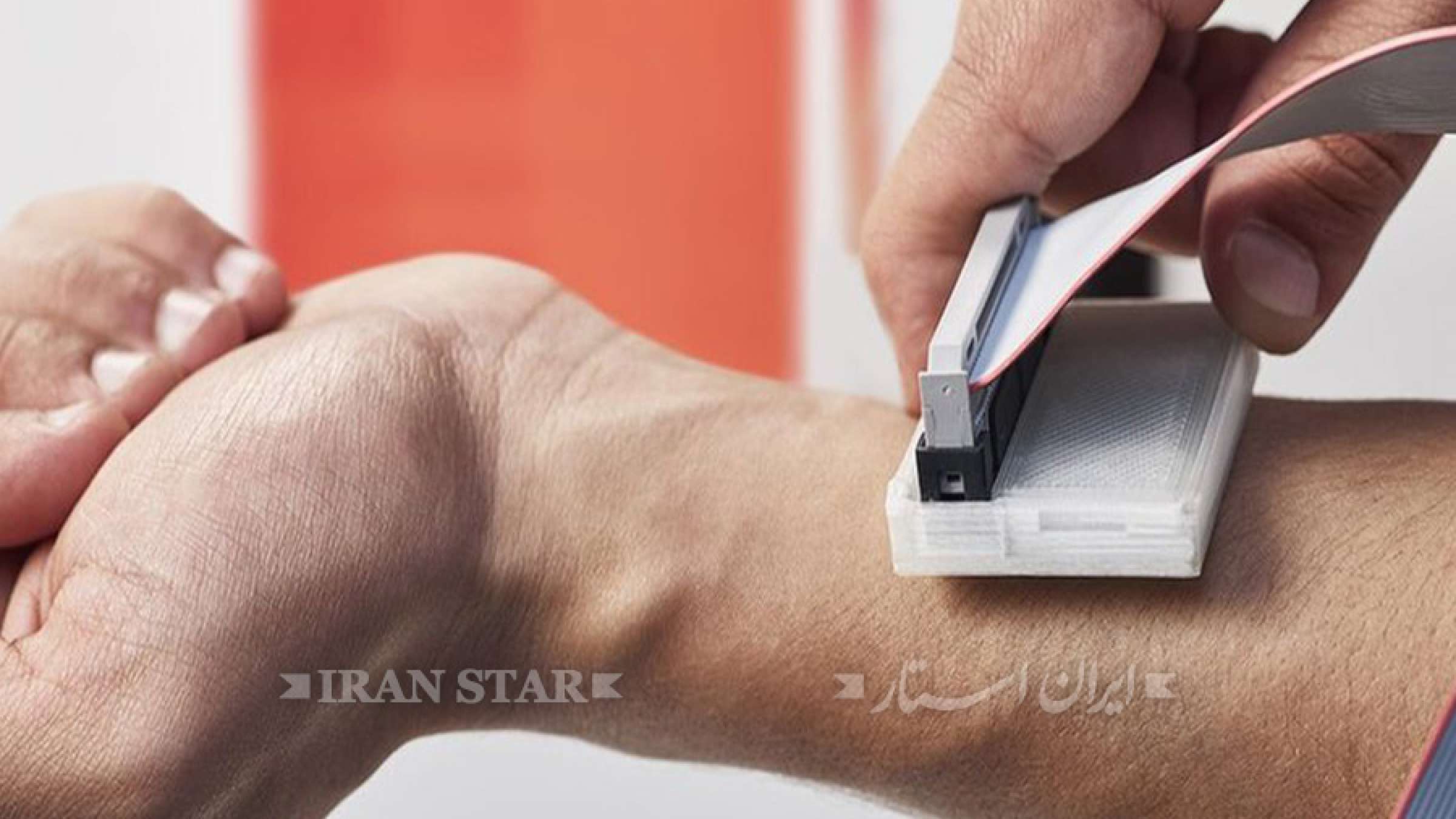 dastgahe-tashkhose-saratane-poost