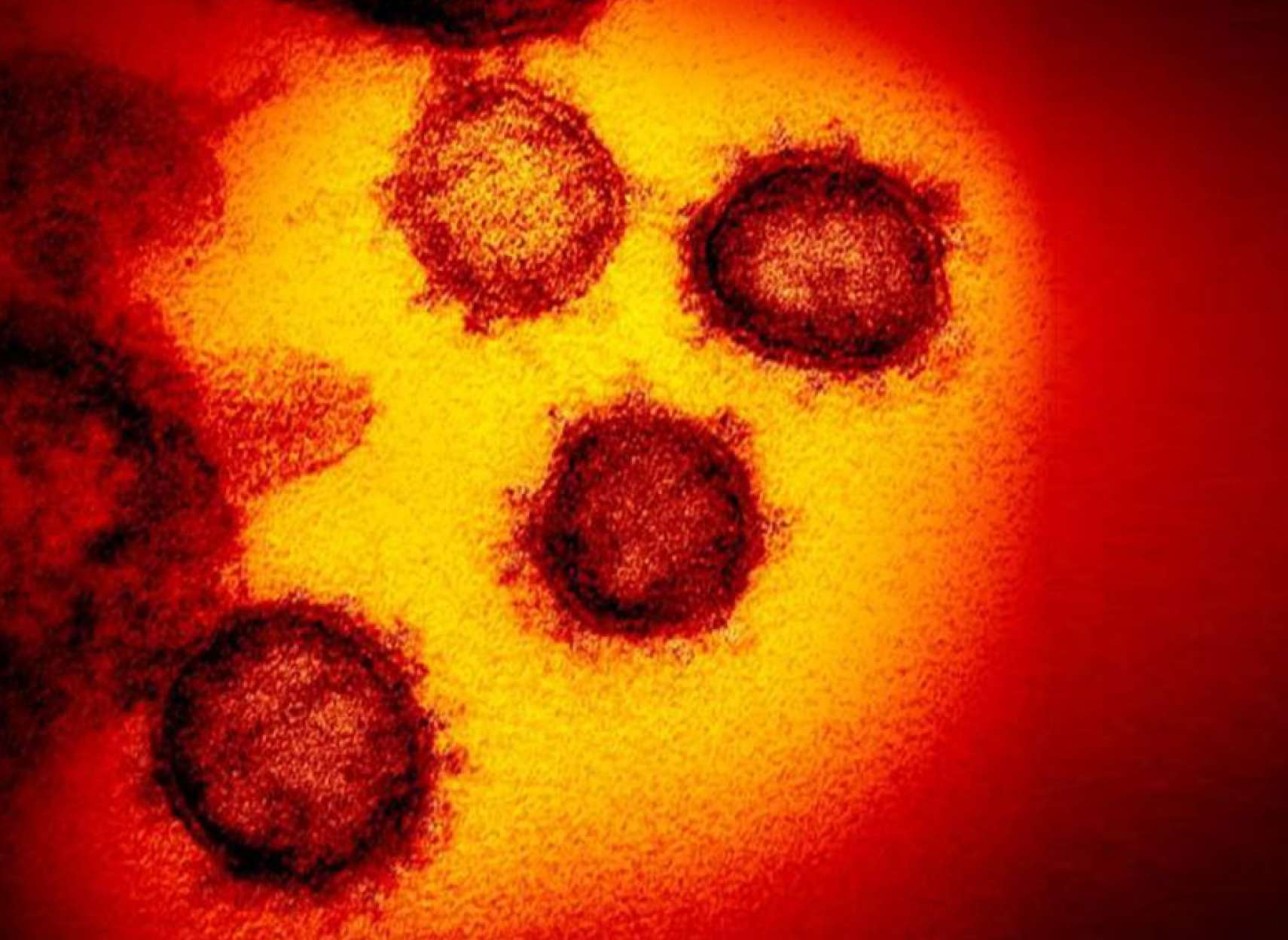 اخبار-کانادا-بیمه-لغو-پرواز-بعلت-کرونا-لغو-شد