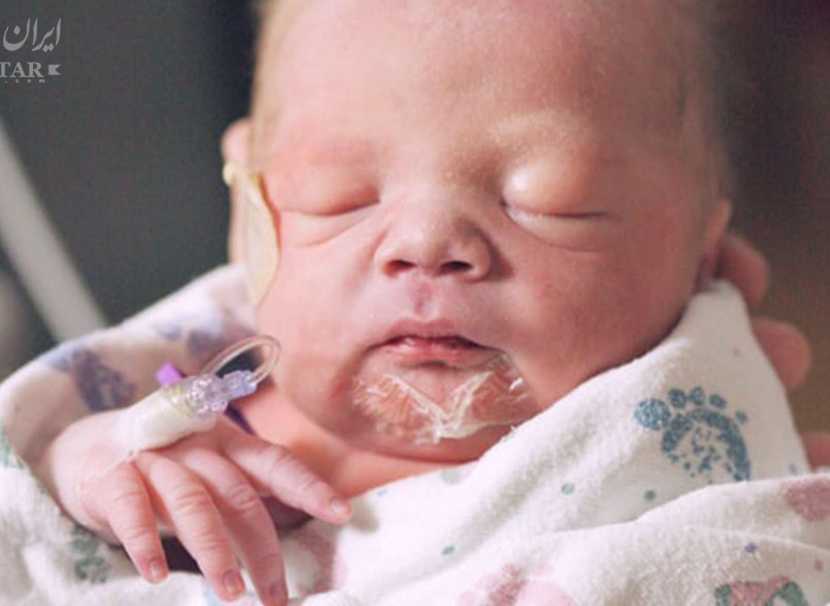 برای-نخستین-بار-نوزادی-با-کرونا-به-دنیا-آمد