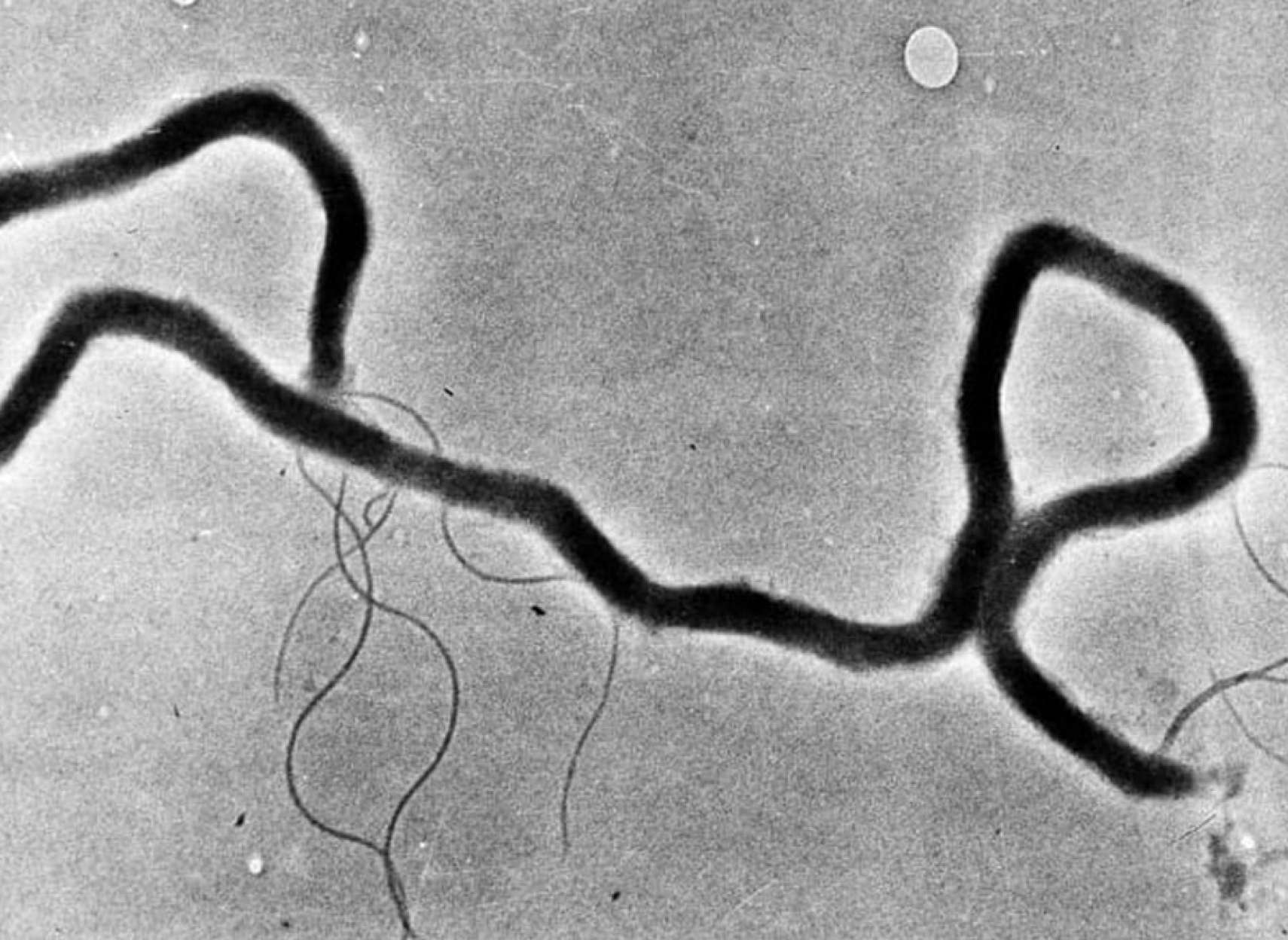 خبر-کانادا-شیوع-وحشتناک-سیفلیس-در-آلبرتا-به-سطح-قبل-از-کشف-آنتی-بیوتیک-رسید