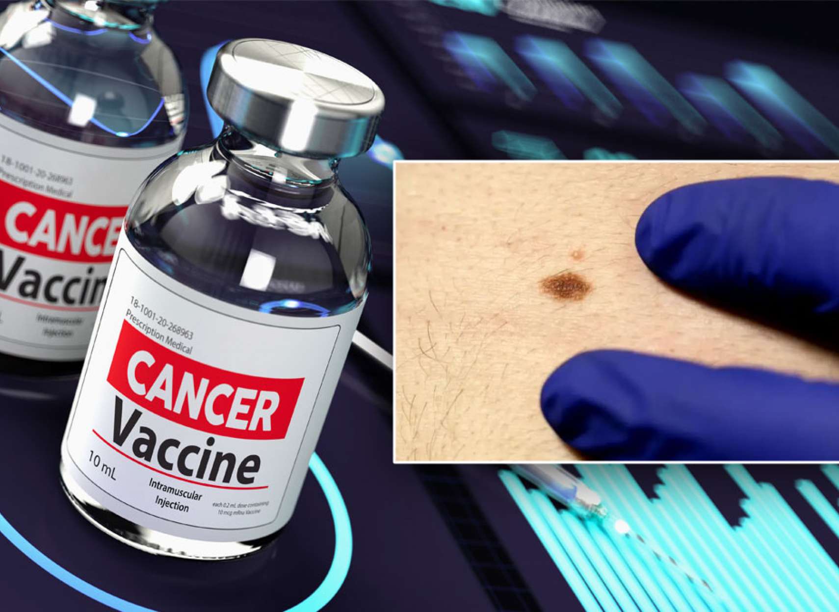 واکسن-جدید-آر-ان-ای-ملانوما-بازگشت-سرطان-پوست-مرگ-ناشی-نصف