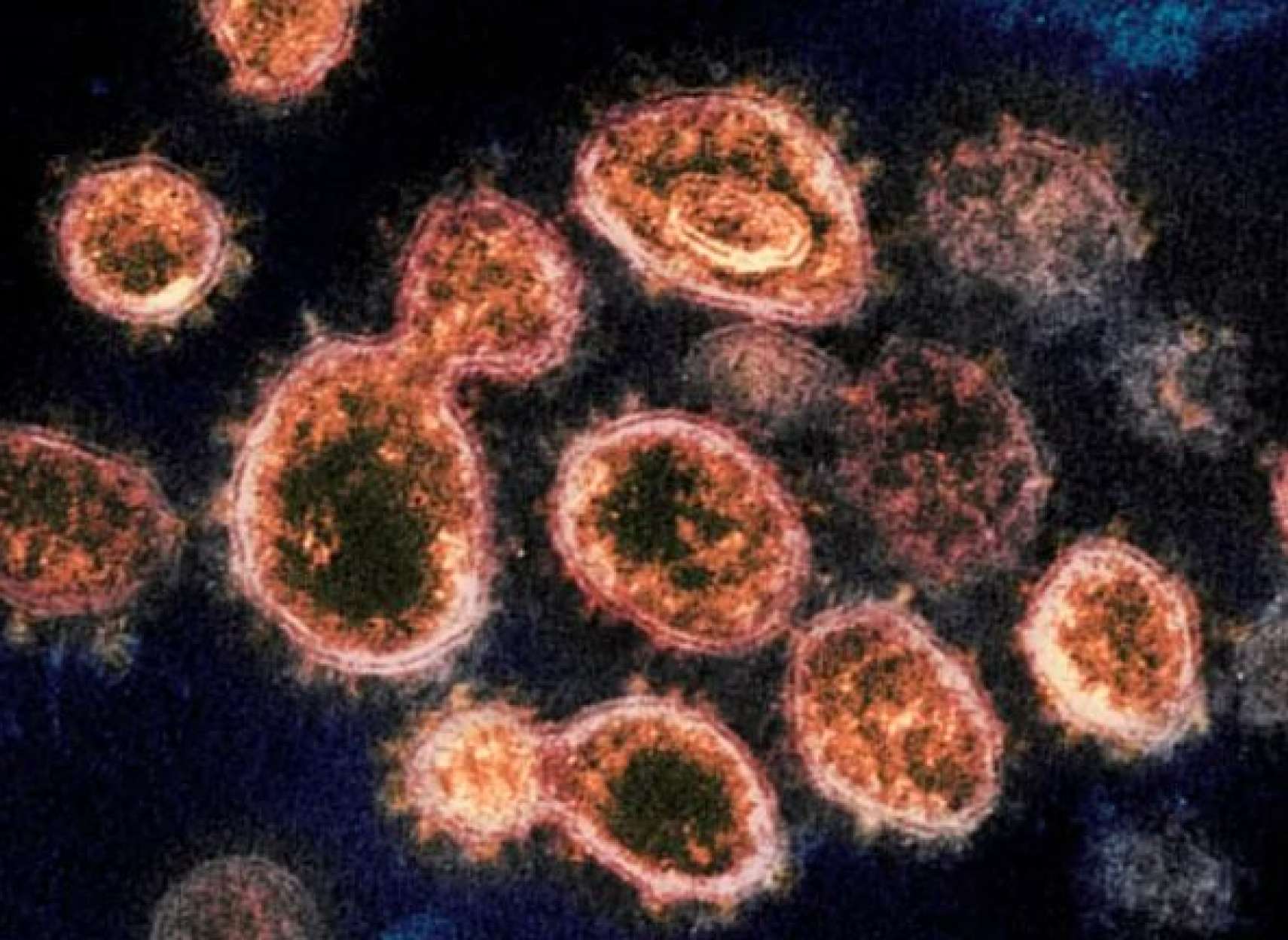 کرونا-به-قاتل-اصلی-جان-کانادا-یی-‌ها-تبدیل-شده-است-رکورد-شکنی-کرونا-در-سه-اونتاریو-آلبرتا-و- کبک-ابتلا-بیش-از- 228 -هزار-آمریکایی-به-کرونا-در-یک-روز