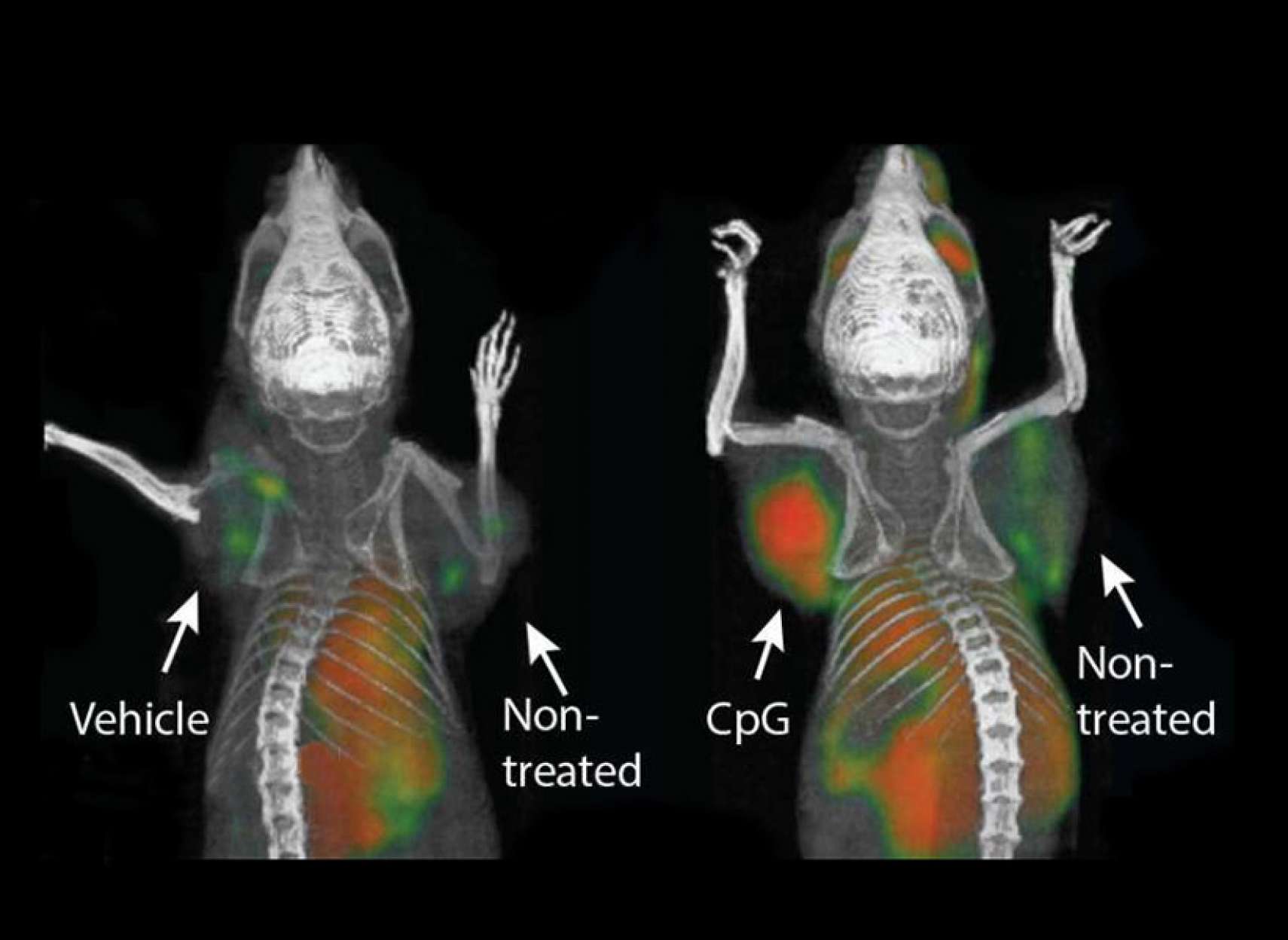 health-vaksan-saratan