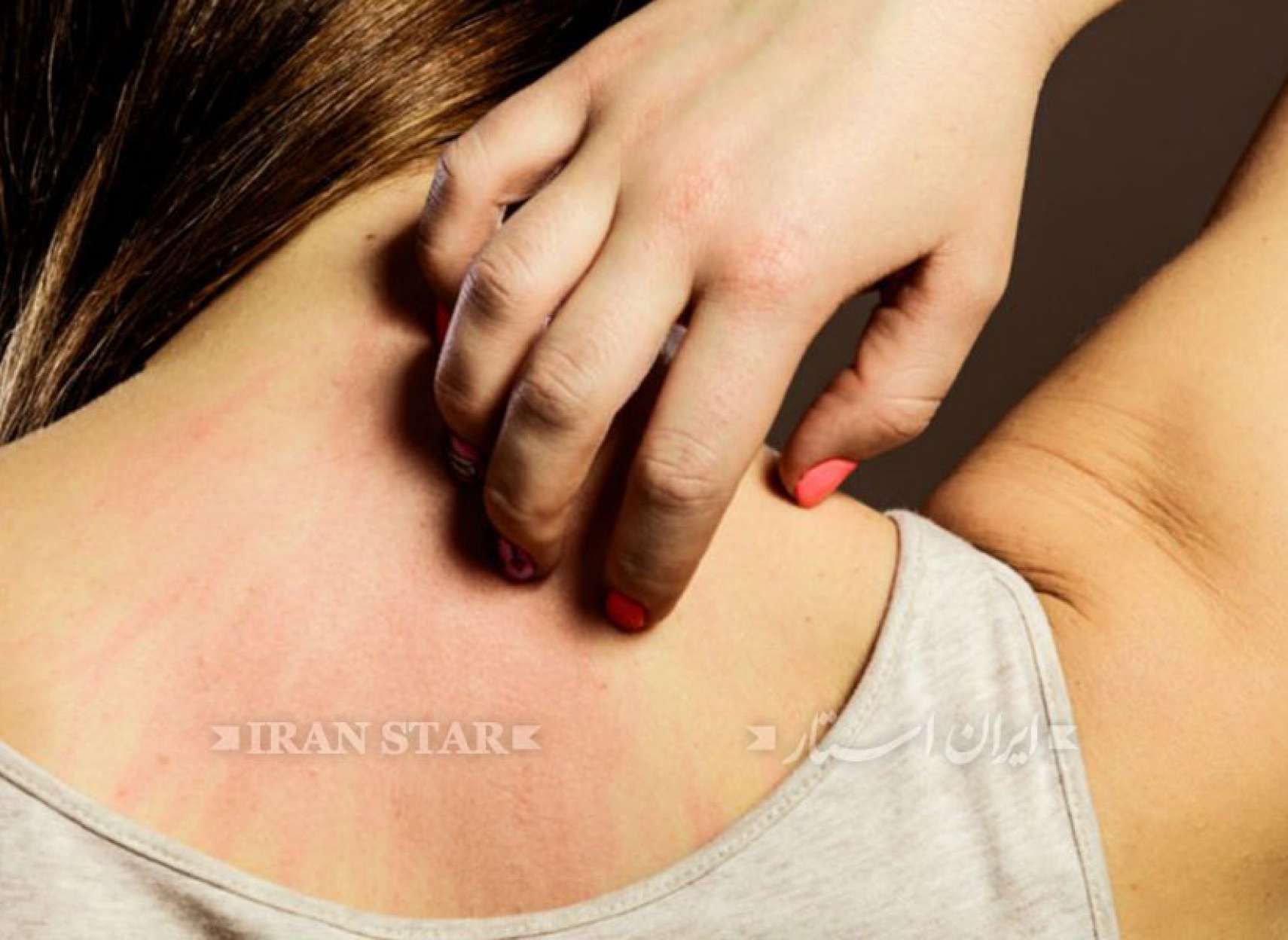 khareshe-tanetan-azkhoshki