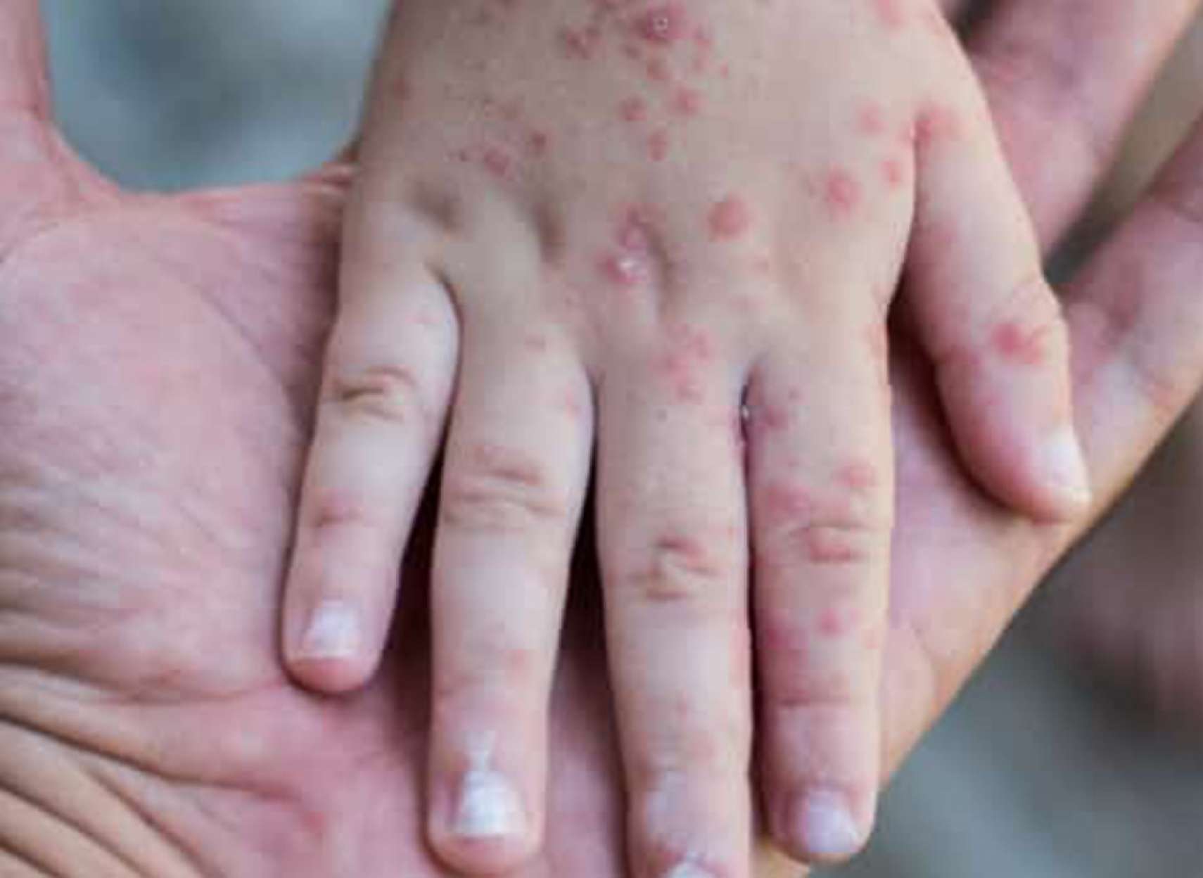 news-sorkhak-toronto