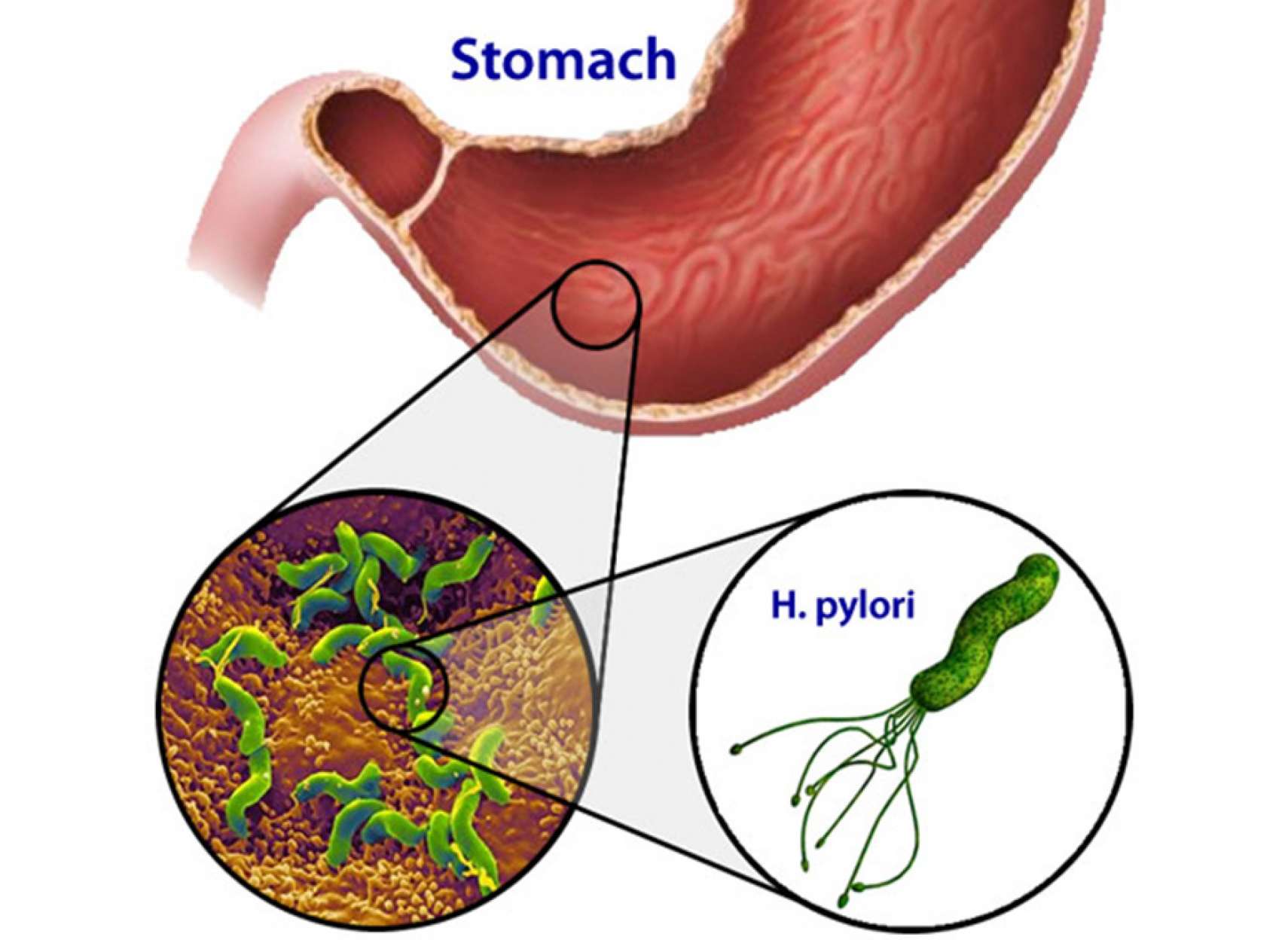 rahimian-insurance-pylori